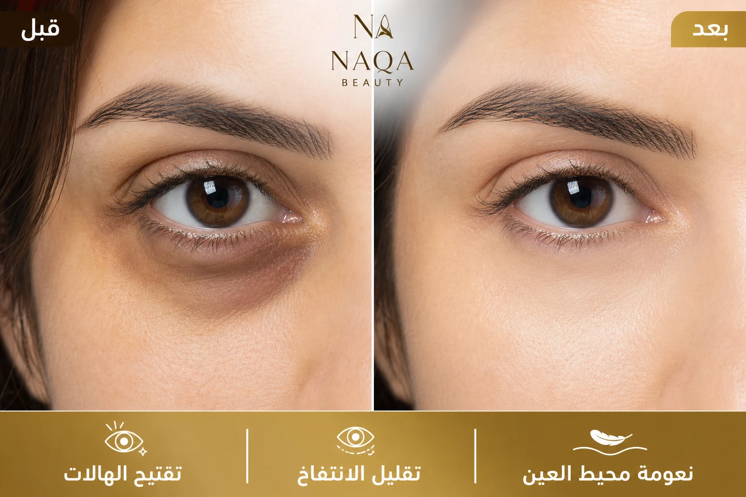 طريقة الاستخدام